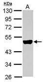 Anti-Cytokeratin 33B antibody used in Western Blot (WB). GTX112454