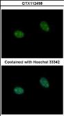 Anti-PRICKLE3 antibody [N1N3] used in Immunocytochemistry/ Immunofluorescence (ICC/IF). GTX112458