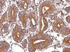 Anti-CTAGE5 antibody used in IHC (Paraffin sections) (IHC-P). GTX112467