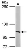 Anti-alanyl-tRNA synthetase antibody [N3C2], Internal used in Western Blot (WB). GTX112477