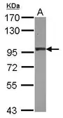 Anti-AP2B1 antibody used in Western Blot (WB). GTX112479