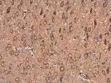 Anti-AMPD2 antibody [N3C3] used in IHC (Paraffin sections) (IHC-P). GTX112483
