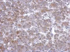 Anti-Hemopexin antibody used in IHC (Paraffin sections) (IHC-P). GTX112519