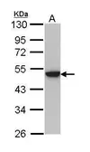 Anti-Cytokeratin 31 antibody [N1C1] used in Western Blot (WB). GTX112530