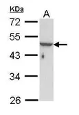 Anti-Cytokeratin 33B antibody [N1C1] used in Western Blot (WB). GTX112531