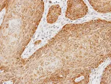 Anti-Kinectin 1 antibody [C2C3], C-term used in IHC (Paraffin sections) (IHC-P). GTX112532