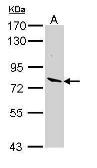 Anti-Lactoperoxidase antibody [C2C3], C-term used in Western Blot (WB). GTX112534