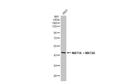 Anti-MAT1A + MAT2A antibody [N1C2] used in Western Blot (WB). GTX112535