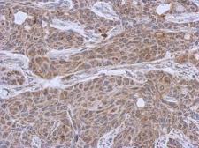 Anti-DLST antibody [N3C3] used in IHC (Paraffin sections) (IHC-P). GTX112555