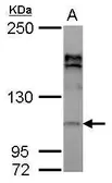 Anti-AP2A2 antibody [N2C1], Internal used in Western Blot (WB). GTX112560