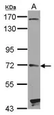Anti-HHIP antibody [C1C3] used in Western Blot (WB). GTX112565
