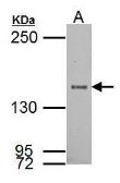 Anti-SRC1 antibody used in Western Blot (WB). GTX112567
