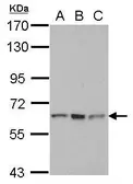 Anti-RNF12 antibody used in Western Blot (WB). GTX112568