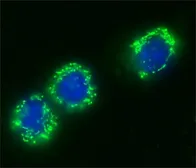 Anti-Centrin 1 antibody used in Immunocytochemistry/ Immunofluorescence (ICC/IF). GTX11257