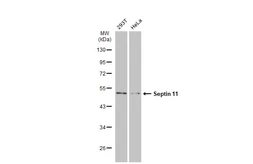 Anti-Septin 11 antibody used in Western Blot (WB). GTX112576