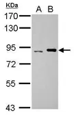 Anti-DNA polymerase iota antibody [N3C2], Internal used in Western Blot (WB). GTX112583