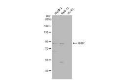 Anti-HHIP antibody [N3C2], Internal used in Western Blot (WB). GTX112584