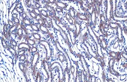Anti-HHIP antibody [N3C2], Internal used in IHC (Paraffin sections) (IHC-P). GTX112584