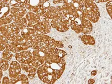 Anti-ERO1L antibody used in IHC (Paraffin sections) (IHC-P). GTX112589