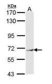Anti-IFIT3 antibody [N1C1] used in Western Blot (WB). GTX112593