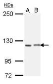 Anti-IGSF3 antibody [N2N3] used in Western Blot (WB). GTX112595