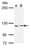 Anti-IGSF3 antibody [N2N3] used in Western Blot (WB). GTX112595