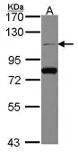 Anti-CDC5L antibody [N2C2], Internal used in Western Blot (WB). GTX112603