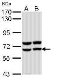 Anti-alpha amylase 2A (pancreatic) antibody [N2C3] used in Western Blot (WB). GTX112606