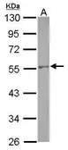 Anti-NAP1L1 antibody used in Western Blot (WB). GTX112613
