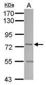 Anti-SNX1 antibody used in Western Blot (WB). GTX112635