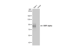 Anti-SIRP alpha antibody used in Western Blot (WB). GTX112645