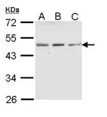 Anti-ENTPD5 antibody [N1N3] used in Western Blot (WB). GTX112650