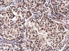 Anti-Nucleophosmin antibody used in IHC (Paraffin sections) (IHC-P). GTX112654