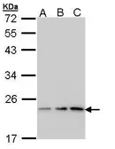 Anti-p23 antibody [N1C3-2] used in Western Blot (WB). GTX112655