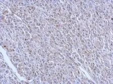Anti-beta Tubulin antibody used in IHC (Paraffin sections) (IHC-P). GTX112658