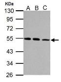 Anti-beta Tubulin antibody used in Western Blot (WB). GTX112658
