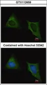 Anti-beta Tubulin antibody used in Immunocytochemistry/ Immunofluorescence (ICC/IF). GTX112659