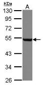 Anti-beta Tubulin antibody used in Western Blot (WB). GTX112659