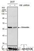 Anti-Vimentin antibody used in Western Blot (WB). GTX112661