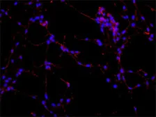 Anti-MAP2 antibody [AP-20] used in Immunocytochemistry/ Immunofluorescence (ICC/IF). GTX11268