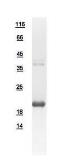 Human BinCARD protein, His tag. GTX112682-pro