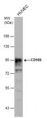 Anti-CD105 antibody [N1N3] used in Western Blot (WB). GTX112684