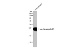 Anti-Apolipoprotein A1 antibody used in Western Blot (WB). GTX112692