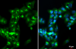Anti-Apolipoprotein A1 antibody used in Immunocytochemistry/ Immunofluorescence (ICC/IF). GTX112692