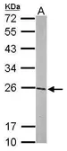 Anti-GSTP1 antibody used in Western Blot (WB). GTX112695