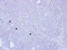 Anti-BST1 antibody used in IHC (Paraffin sections) (IHC-P). GTX112703