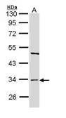 Anti-BST1 antibody [N1C3] used in Western Blot (WB). GTX112704