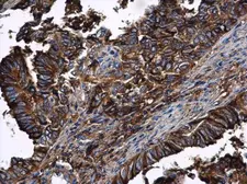 Anti-alpha 1 Antitrypsin antibody [N1C2] used in IHC (Paraffin sections) (IHC-P). GTX112707