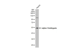 Anti-alpha 1 Antitrypsin antibody [N1C2] used in Western Blot (WB). GTX112707