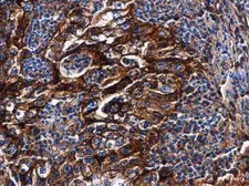 Anti-HLA-G antibody used in IHC (Paraffin sections) (IHC-P). GTX112713